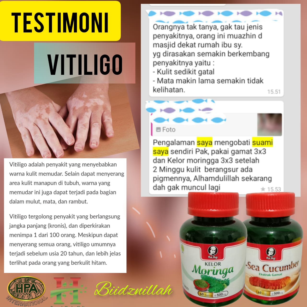 Testimoni Vitiligo dengan Moringa dan G-Sea Cucumber