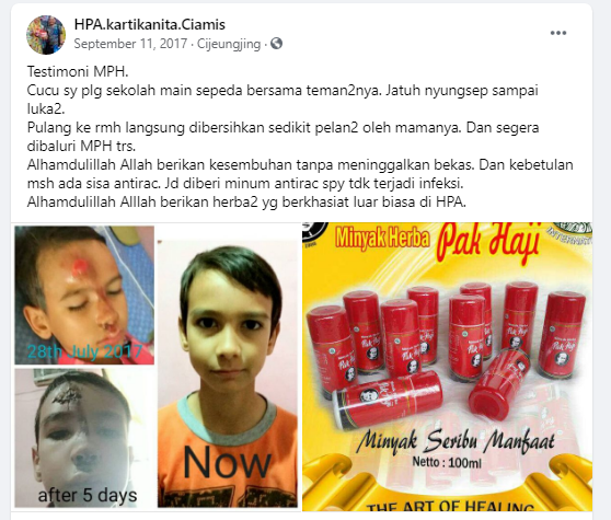 Testimoni MPH untuk luka-luka