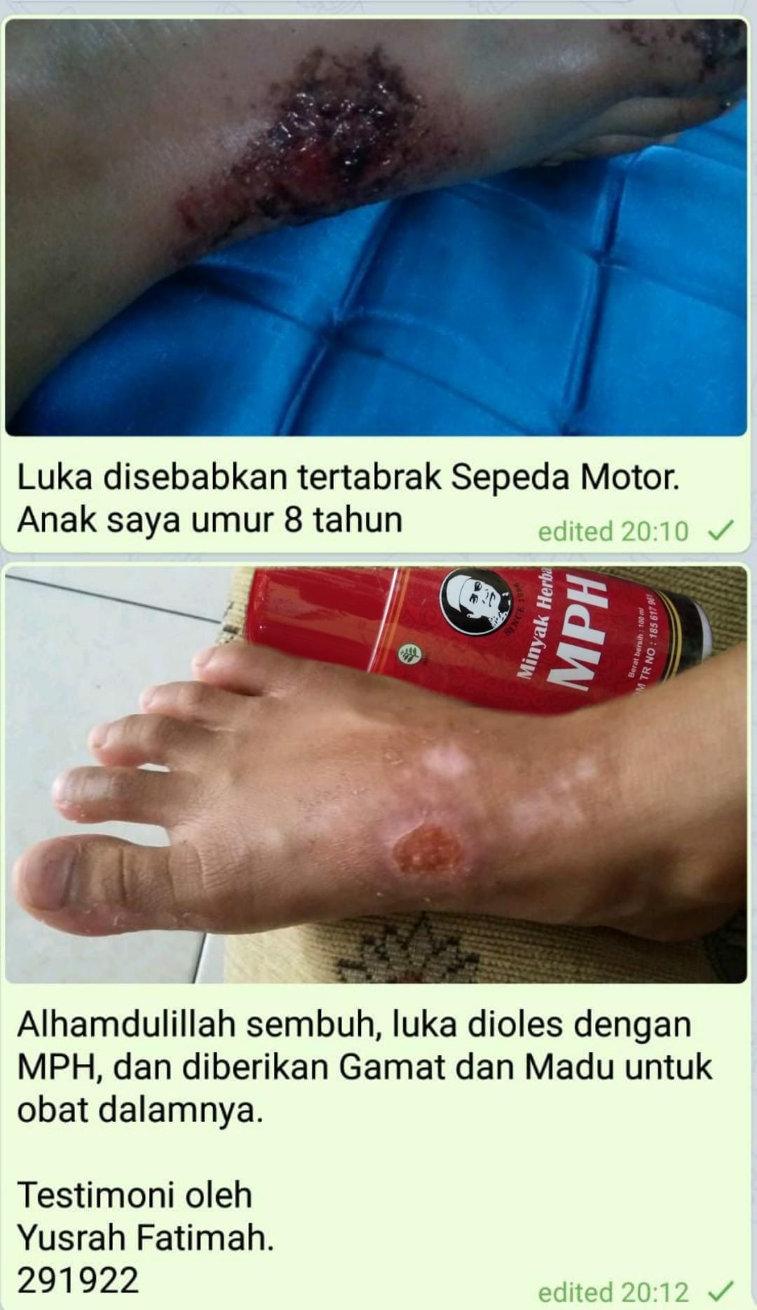 Testimoni MPH untuk Luka tertabrak Sepeda Motor