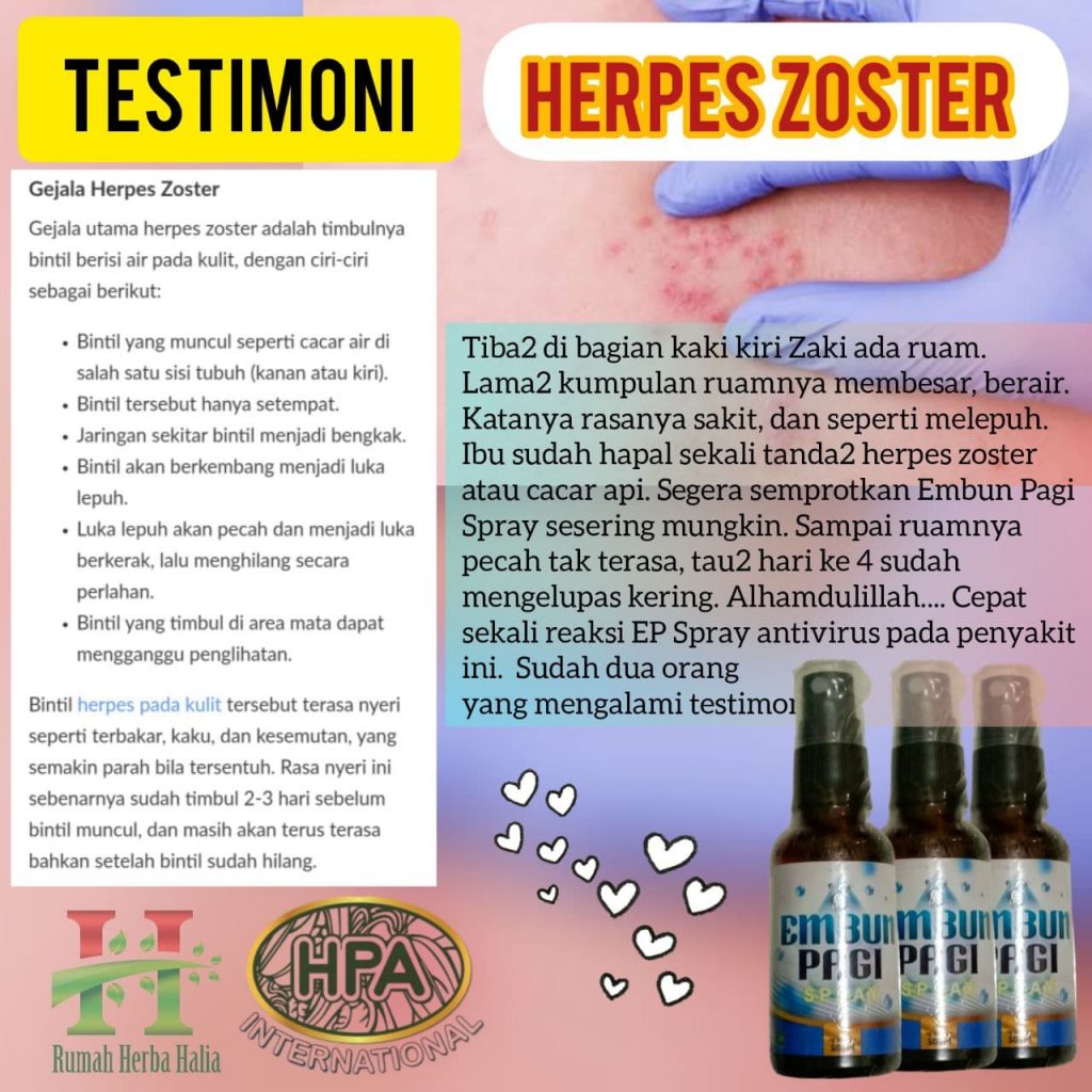 Testimoni Herpes Zoster