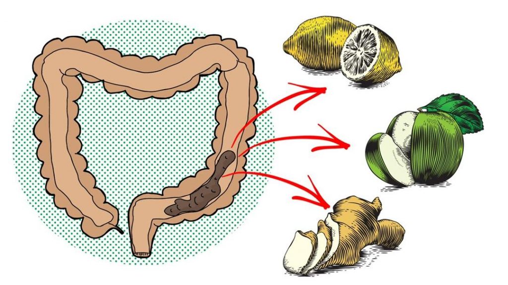 Inilah kondisi sisa pencernaan yang menyumbat usus besar