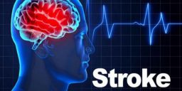 Kuliah Tuan Haji Ttg Minyak Pak Haji Yang Menyembuhkan Stroke Dan Jantung