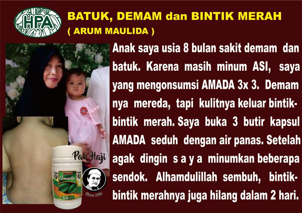 Testimoni Batuk, Demam dan Bintik Merah menggunakan Temu Mangga - Amada