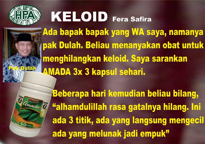 Kapsul Amada sembuhkan keloid