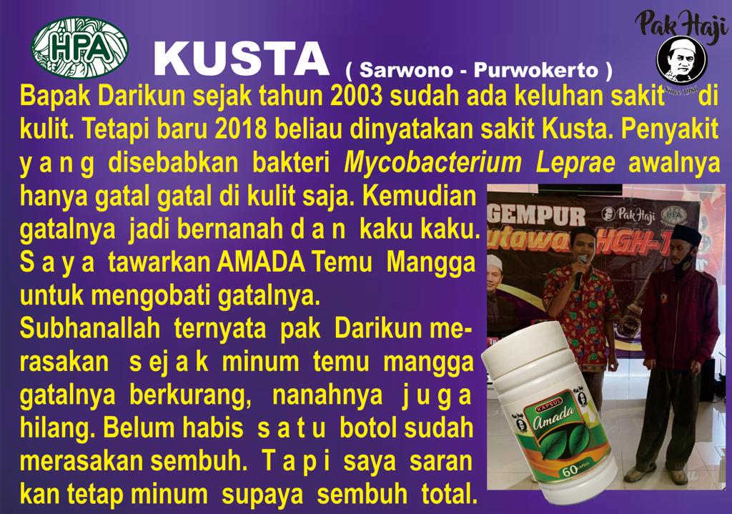 Testimoni Temu Mangga untuk Kusta (yang diawali dengan gatal-gatal dikulit)