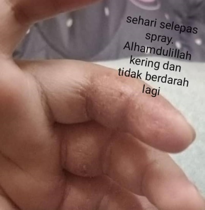 Keadaan Setelah diberikan HGH T