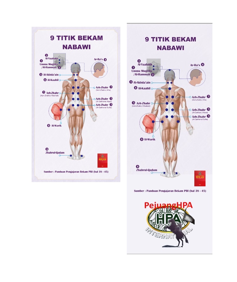 Poster-poster 9 titik bekam sunnah